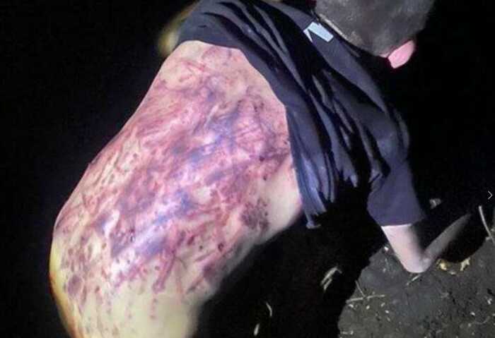 «Я тебе заріжу»: військовий розповів про катування й залякування в частині під Вовчанськом